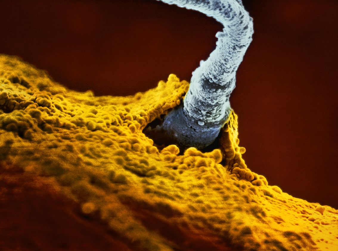Microskopisk bild av en spermie som tränger in i ett ägg.