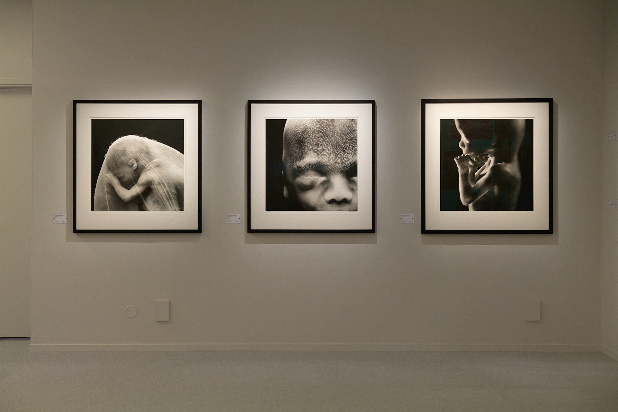 Tre svartvita fotografier bredvid varandra på en vägg. Fotografierna föreställer foster.